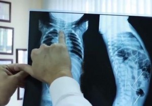 Chủ đề sức khỏe số 2: NHỮNG ĐIỀU CẦN LƯU Ý KHI CHỤP X QUANG CHO BÉ